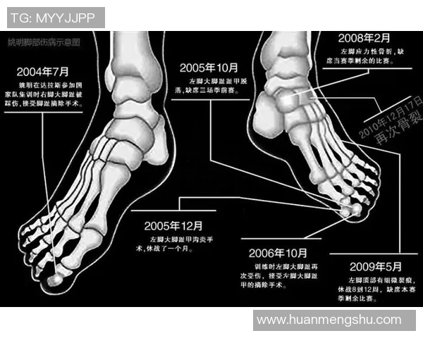 左脚应力性反应&本季还未出战!Scotto:尼昂一周后接受复查 左脚应力性反应&本季还未出战!Scotto:尼昂一周后接受复查